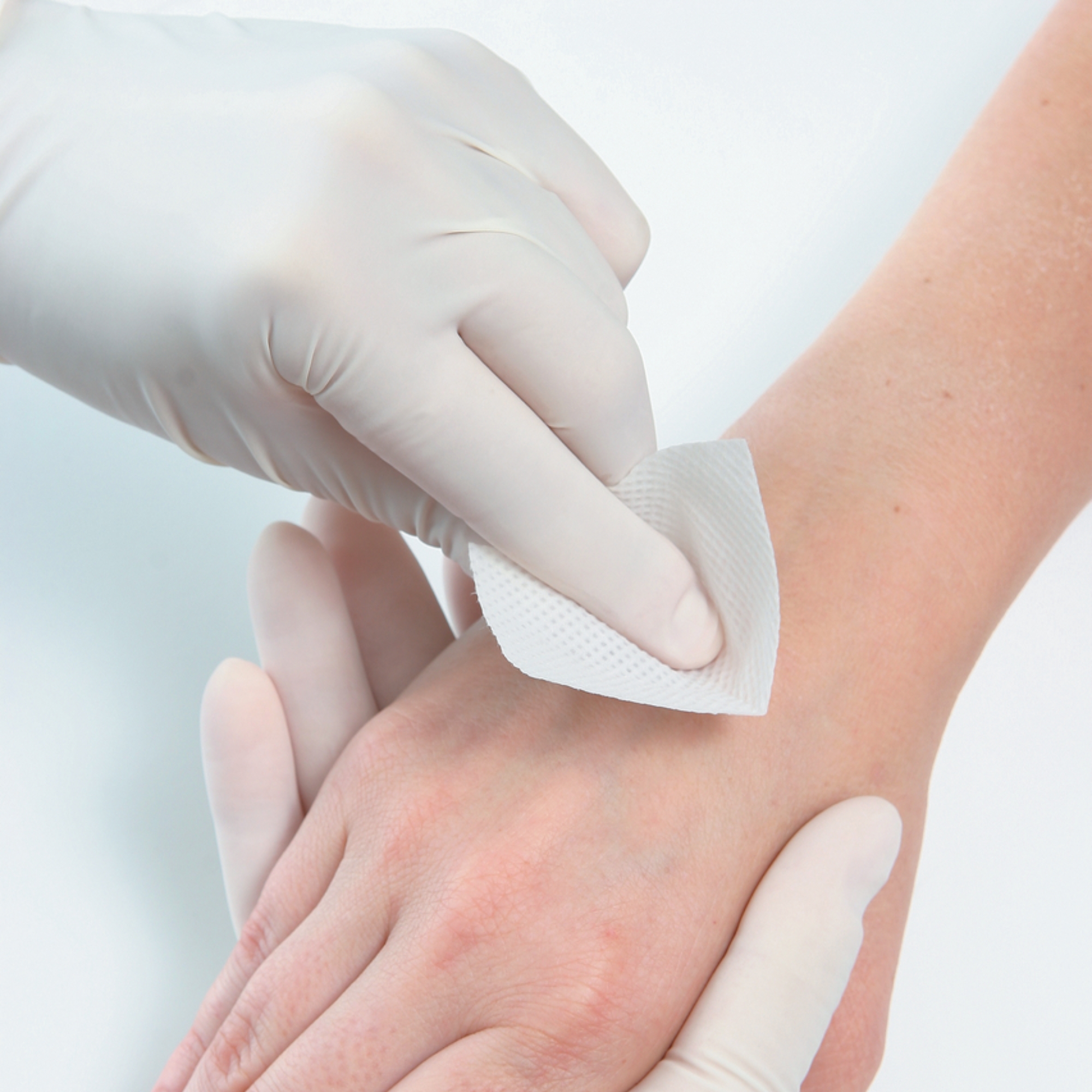 PDI® Adhesive Remover, 3 x 6.6 Centimeter Wipe - Image 5