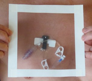 HydroSeal Sleeve Arm Cast Protector - Image 2