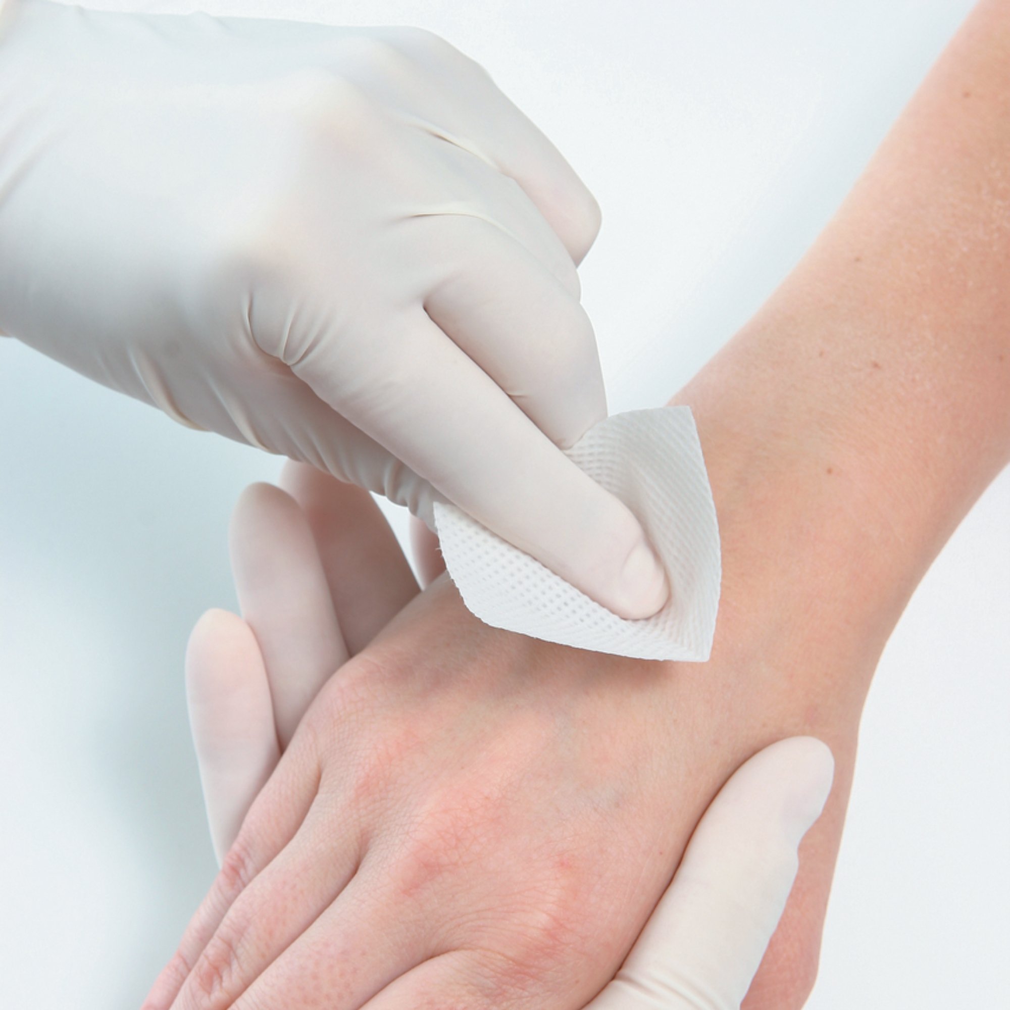 Io-Gone Iodine Removal Wipe, 3 x 6.6 centimeters - Image 4