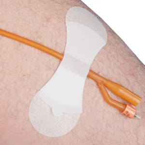 Zefon Grip-Lok Securement Device for Large Universal Catheter and Tubing