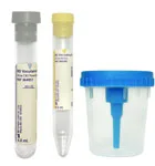 BD Vacutainer Urine Collection Kit with Screw Cap Cup