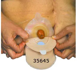 Cymed Two-piece Colostomy Closed-end Mini Pouch