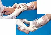 Derma Sciences Surgilast Tubular Elastic Bandage Retainer
