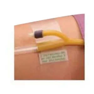 Dale Hold-N-Place Adhesive Patch Foley Catheter Holder