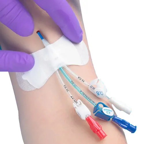 Zefon TIDI Grip-Lok Securement Device