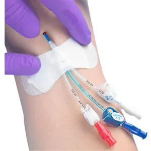 Zefon TIDI Grip-Lok Securement Device
